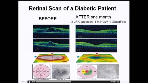 Interview with Dr Galvez A Deep Dive Into The Science